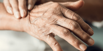 La enfermedad de Parkinson: qué es y cuáles son las novedades en su tratamiento