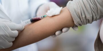 Por qué el verano es el mejor momento para realizarse el control médico anual