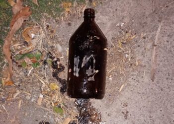 «Pamela no va a ser la misma»: el dolor de la familia de la mujer atacada con ácido