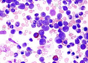 Avances científicos mejoran el pronóstico de la leucemia más frecuente