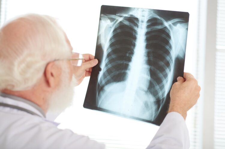 Tuberculosis.