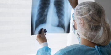 Fuerte aumento de casos de tuberculosis expone la crisis del sistema de salud argentino