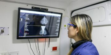 Detección temprana del cáncer de mama: el mamógrafo móvil en el sur cordobés
