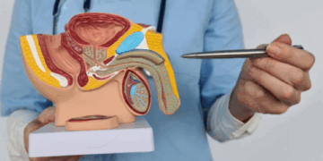 Cada vez más pacientes buscan revertir la vasectomía en Argentina Vasectomía.