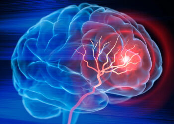 Cada minuto cuenta: Córdoba promueve la detección temprana del ACV con una acción en la vía pública.