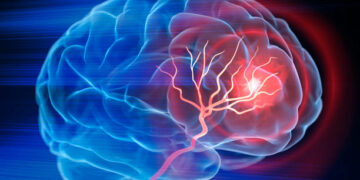 Cada minuto cuenta: Córdoba promueve la detección temprana del ACV con una acción en la vía pública. Cada minuto cuenta: Córdoba promueve la detección temprana del ACV con una acción en la vía pública.