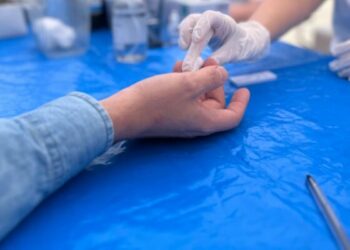 Día Mundial de Lucha contra el VIH