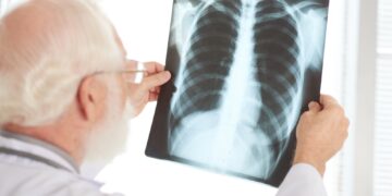 La enfermedad se transmite por el aire, cuando una persona con la infección tose, estornuda o habla.