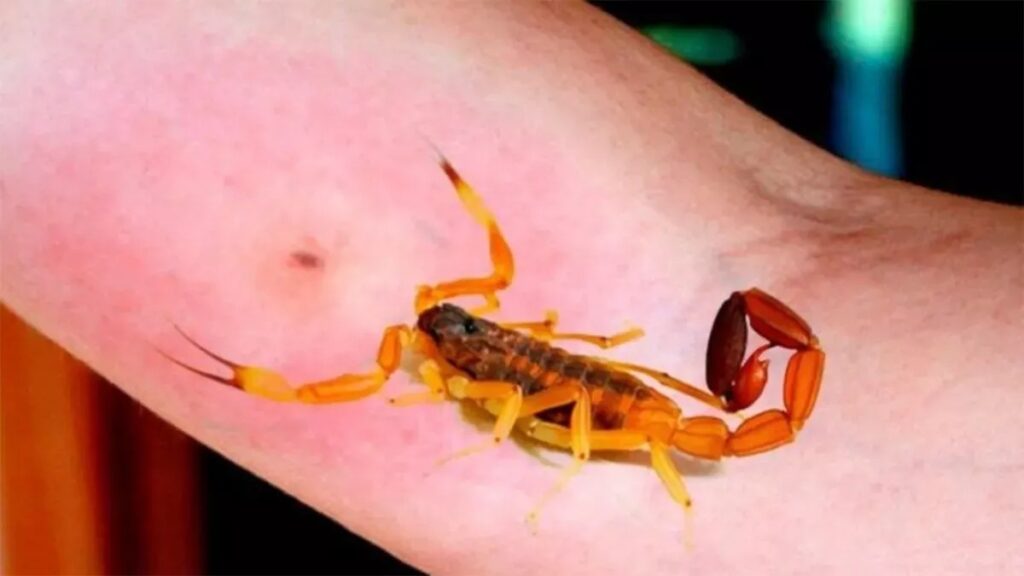 Un niño está internado desde el domingo por la picadura de un alacrán