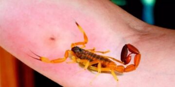 Un niño está internado desde el domingo por la picadura de un alacrán Un niño está internado desde el domingo por la picadura de un alacrán