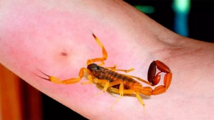 Un niño está internado desde el domingo por la picadura de un alacrán