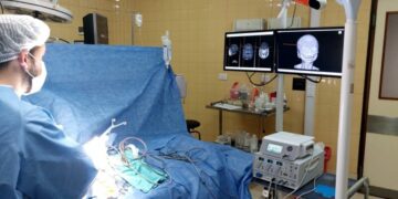 La intervención, que tuvo una duración aproximada de cuatro horas, se desarrolló íntegramente bajo visión microscópica, lo que permitió la extracción completa de la lesión sin complicaciones.