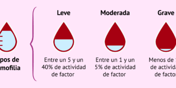 Aprueban en Argentina un innovador tratamiento para la hemofilia Aprueban en Argentina un innovador tratamiento para la hemofilia