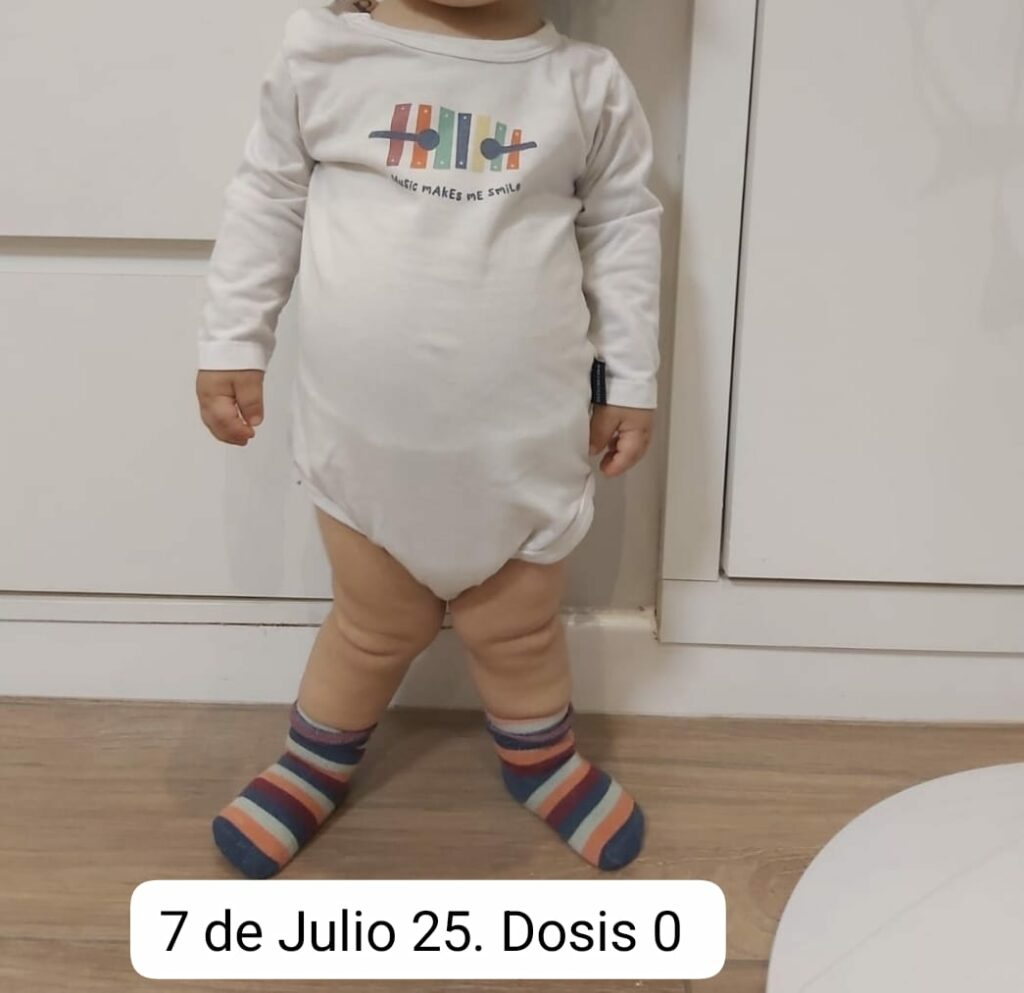 Franco tiene tres años y su salud depende de un tratamiento que el Estado le niega