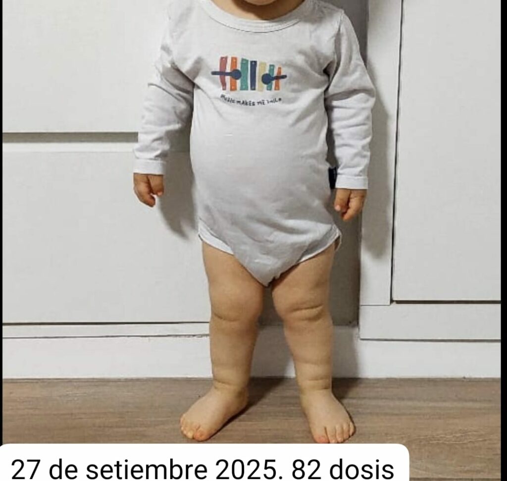 Franco tiene tres años y su salud depende de un tratamiento que el Estado le niega