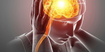 Dolor de cabeza recurrente: cuándo sospechar migraña y consultar a un especialista