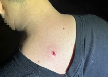 Detienen a dos hombres por disparar con aire comprimido desde un edificio