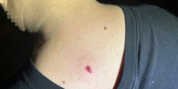 Detienen a dos hombres por disparar con aire comprimido desde un edificio