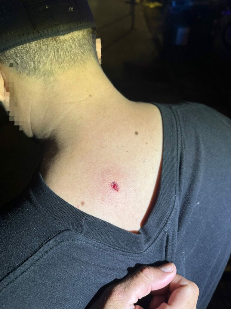 Detienen a dos hombres por disparar con aire comprimido desde un edificio