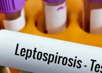 Un hombre murió por leptospirosis en Bell Ville Un hombre murió por leptospirosis en Bell Ville