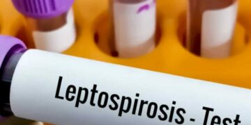 Un hombre murió por leptospirosis en Bell Ville