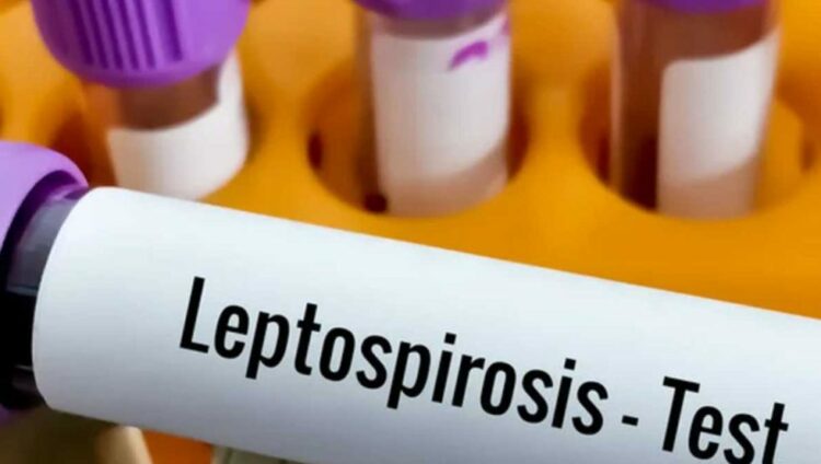 Un hombre murió por leptospirosis en Bell Ville Se trata del cuarto caso fatal en la provincia en los últimos cinco años.