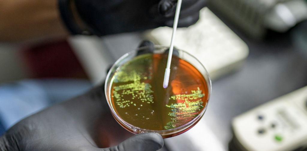 Investigadores de la UNC crean alternativas para combatir infecciones resistentes Investigadores de la UNC crean alternativas para combatir infecciones resistentes