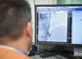 El Hospital Córdoba realizó la primera angioplastia coronaria con soporte mecánico