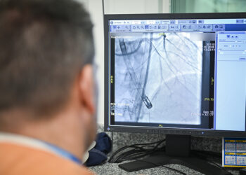 El Hospital Córdoba realizó la primera angioplastia coronaria con soporte mecánico