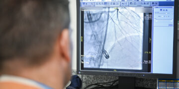 El Hospital Córdoba realizó la primera angioplastia coronaria con soporte mecánico