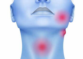Advierten un aumento de los casos de cáncer de cabeza y cuello vinculados al VPH Advierten un aumento de los casos de cáncer de cabeza y cuello vinculados al VPH