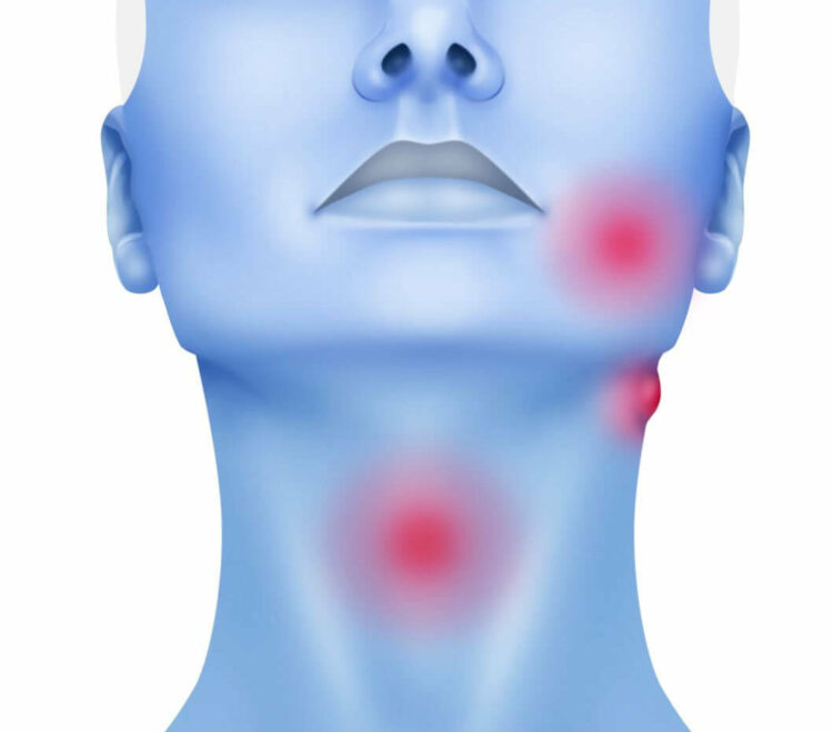 Especialistas alertan sobre el aumento de los tumores de cabeza y cuello asociados al VPH, una tendencia que crece entre personas jóvenes y refuerza la importancia de la prevención y el diagnóstico precoz.