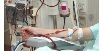 Alerta en diálisis: los aranceles de PAMI cayeron y peligra la atención de afiliados diálisis