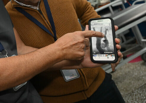 El Hospital de Niños realizó la primera colocación de un stent bioabsorbible a un bebé