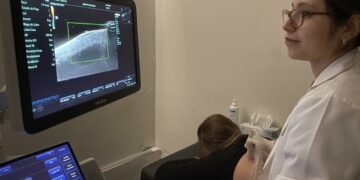 El Hospital San Roque incorporó un equipo único en el país para mejorar diagnósticos