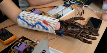 El dispositivo utiliza señales musculares para controlar una mano artificial y se fabrica con impresión 3D.