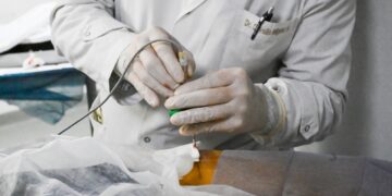 Realizan por primera vez en un hospital provincial una ablación para tratar un tumor óseo Este hito permite ampliar el acceso a tecnologías de vanguardia y a procedimientos mínimamente invasivos.